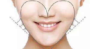 北京吸脂瘦脸专家排行 北京艾玛李方奇 22年精湛技术