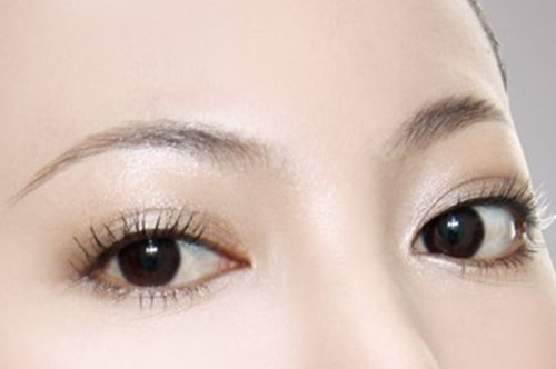 杭州康森整形医院双眼皮手术方法以及好处