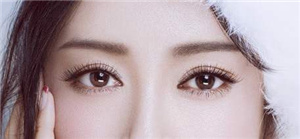 长沙爱思特双眼皮修复方法有哪些 张姣姣20年修复技术