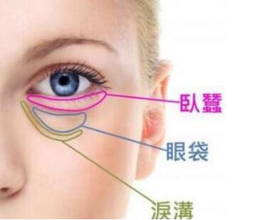 北京精艺吉美整形医院激光去眼袋多少钱 20分钟解决眼袋