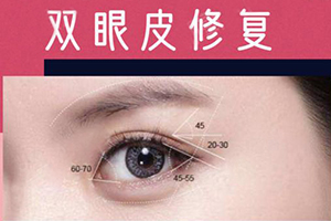 双眼皮失败可以修复好吗 北京伊美尔长岛割双眼皮修复价格