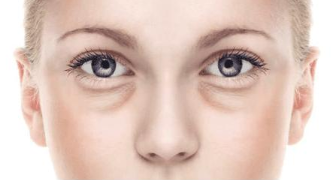 手术祛眼袋的方法 合肥光美整形让眼周平滑紧致 告别眼袋