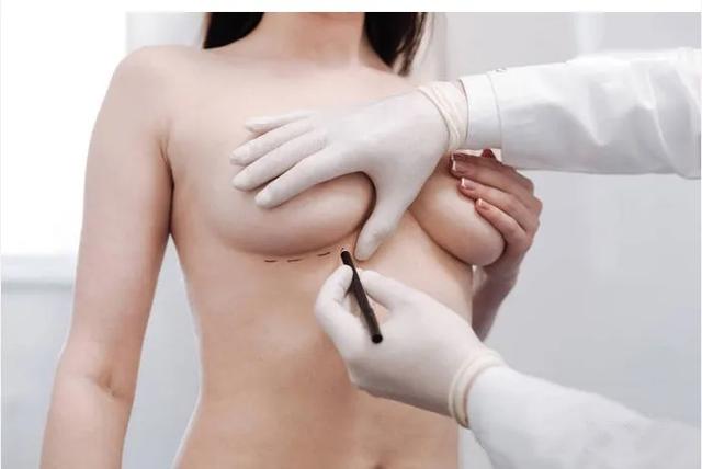 乳房下垂矫正手术费用是多少 2021价格一览表