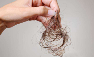头发重生的希望 头发种植安全吗 通过植发治疗秃顶可行吗