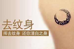 做激光洗纹身还有什么优势 桂林时光整形医院专业吗