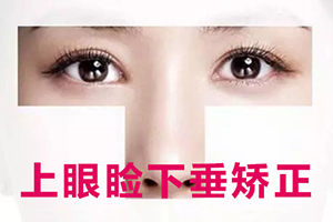 上眼睑下垂矫正的过程 杭州伊琳整形医院改善眼睑下垂