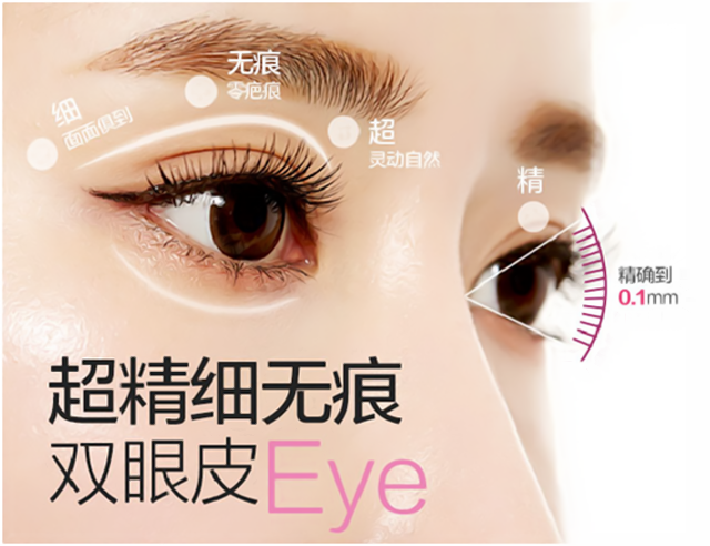 海南韩美整形医院做双眼皮修复 无痛无痕 自然成型