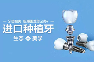 北京口腔医院哪里好 牙管家呵护牙齿健康 附种植牙价格