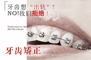 广州专业牙科医院 信诚口腔正规技术好 矫正需多少钱