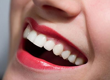 上海口腔医院推荐 牙卫士口腔牙齿矫正价格贵吗 要多久