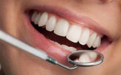 北京西诺口腔专业牙齿矫正 牙齿矫正适应症 露出自信微笑