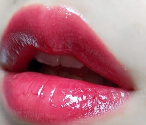 杭州安法整形医院漂唇价格一览 设计性感红唇