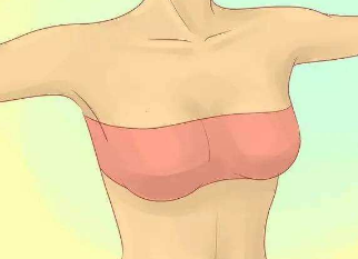 吸脂去副乳效果怎么样 天津西青国风整形恢复胸部形态