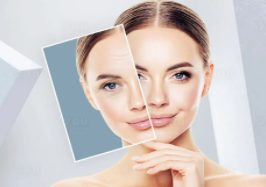  How long will the price of medical plastic hyaluronic acid wrinkle removal take effect in Liuzhou Beauty Focus