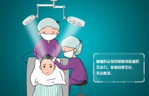 重庆骑士植发美容医院头发种植优势 解决多年脱发困扰