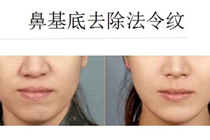  Wuhan Qudan Vein Beauty and Beauty Clinic Regular Laser Qudan Vein Effect Picture