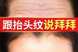  Kunming Wrinkle Removal Yuemei Cosmetic Clinic Laser Removing Scallops Price Restores Youth