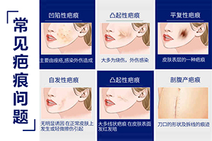  Shaoxing Huamei Beauty and Plastic Surgery Hospital How much does laser scar removal cost to make skin flawless