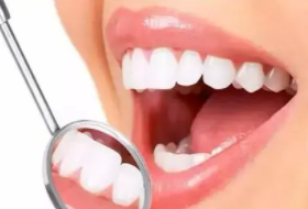  Advantages of orthodontics in Chongqing TAL Dental Clinic to improve tooth shape