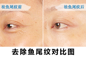  Fuzhou Wenyueri Hospital Li Feng Medical Beauty Clinic is worth choosing and has lasting effect